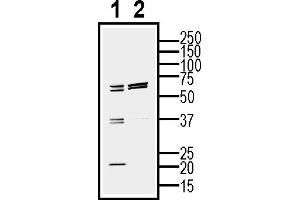 Western blot analysis of mouse  cell line lysate (lane 1) and BV2-derived purified exosomes (lane 2)50 μg of cells and purified exosomes lysates were analyzed using Anti-CD81 (extracellular) Antibody (ABIN7581847), (1:200). (CD81 Antikörper  (Extracellular))