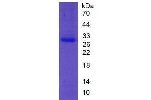 Image no. 1 for Paraoxonase 1 (PON1) (AA 35-206) (Active) protein (His tag) (ABIN5665889) (PON1 Protein (AA 35-206) (His tag))
