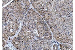 IHC analysis of CSNK2K2 using anti-CSNK2K2 antibody (ABIN7602871). (CSNK2A2 Antikörper  (C-Term))