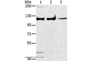 Western blot analysis of Human fetal muscle tissue, A172 and K562 cell, using MAPK7 Polyclonal Antibody at dilution of 1:250 (MAPK7 Antikörper)