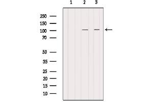 Western blot analysis of extracts from various samples, using PDE6A Antibody. (PDE6A Antikörper  (N-Term))