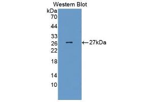 Western blot analysis of the recombinant protein. (SLAMF1 Antikörper  (AA 17-227))