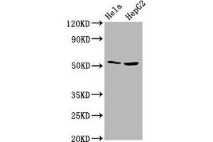 Western Blot Positive WB detected in: Hela whole cell lysate, HepG2 whole cell lysate All lanes: THNSL2 antibody at 4. (THNSL2 Antikörper  (AA 295-441))