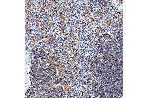 IHC analysis of SH2D4A using anti-SH2D4A antibody (ABIN7601695).