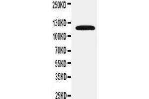 Anti-SLC12A1 antibody, Western blotting WB: Rat Kidney Tissue Lysate (SLC12A1 Antikörper  (N-Term))