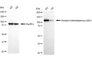 Western blotting analysis using phospho-retinoblastoma (S807) antibody (ABIN7800188). (Rekombinanter Retinoblastoma Protein (Rb) Antikörper  (pSer807))