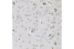 Immunohistochemistry of paraffin-embedded mouse brain using CEACAM5 antibody. (CEACAM5 Antikörper)