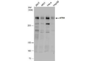 WB Image ATRX antibody detects ATRX protein by western blot analysis. (ATRX Antikörper  (C-Term))