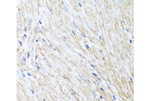 Immunohistochemistry of paraffin-embedded Mouse heart using L2HGDH Polyclonal Antibody at dilution of 1:100 (40x lens). (L2HGDH Antikörper)