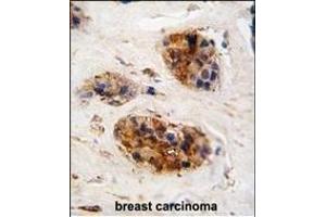 Immunohistochemistry (Paraffin-embedded Sections) (IHC (p)) image for anti-Vimentin (VIM) (AA 152-181) antibody (ABIN389213)