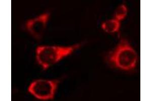 ABIN6274246 staining 293 cells by IF/ICC. (Activin A Receptor Type IB/ALK-4 Antikörper  (Internal Region))