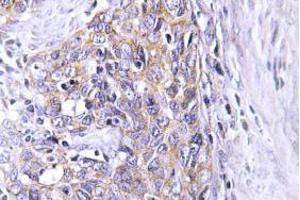 Image no. 2 for anti-Ceroid-Lipofuscinosis, Neuronal 6, Late Infantile, Variant (CLN6) antibody (ABIN317825) (CLN6 Antikörper)