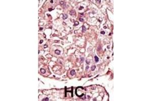 Immunohistochemistry (IHC) image for anti-Transforming Growth Factor, beta Receptor 1 (TGFBR1) antibody (ABIN3003515)