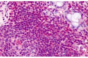 Human Lymphocytes: Formalin-Fixed, Paraffin-Embedded (FFPE) (CCDC50 Antikörper  (AA 468-481))