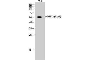 Western Blotting (WB) image for anti-Myelin Expression Factor 2 (MYEF2) (pThr319) antibody (ABIN3172926) (MYEF2 Antikörper  (pThr319))