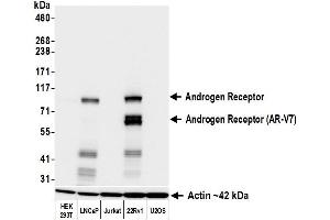 Western Blotting (WB) image for anti-Androgen Receptor (AR) (AA 1-50) antibody (ABIN7795785)