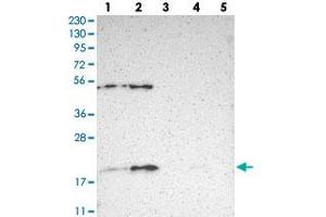 Western blot analysis of Lane 1: RT-4, Lane 2: U-251 MG, Lane 3: Human Plasma, Lane 4: Liver, Lane 5: Tonsil with APOO polyclonal antibody . (APOO Antikörper)