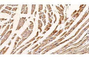 Detection of C1QBP in Mouse Cardiac Muscle Tissue using Polyclonal Antibody to Complement component 1 Q subcomponent-binding protein, mitochondrial (C1QBP) (C1QBP Antikörper  (AA 71-278))