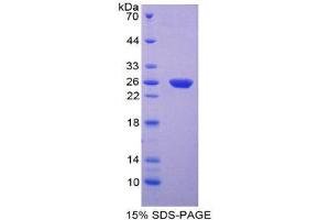 SDS-PAGE (SDS) image for Hexokinase 2 (HK2) (AA 469-669) protein (His tag) (ABIN1981130)