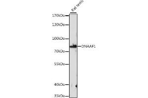 Western blot analysis of extracts of rat testis, using DN antibody (ABIN7268219) at 1:1000 dilution. (LRRC50 Antikörper  (AA 516-725))