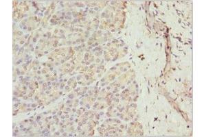 Immunohistochemistry of paraffin-embedded human pancreatic tissue using ABIN7167363 at dilution of 1:100 (Rab5c Antikörper  (AA 1-216))