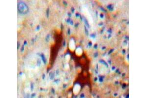 IHC-P analysis of Liver tissue, with DAB staining. (ASK1 Antikörper  (AA 693-933))