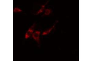 ABIN6274861 staining Hela cells by IF/ICC. (ARFIP1 Antikörper  (Internal Region))