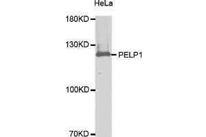 Western Blotting (WB) image for anti-Proline-, Glutamic Acid- and Leucine-Rich Protein 1 (PELP1) (AA 1021-1180) antibody (ABIN3023502) (PELP1 Antikörper  (AA 1021-1180))