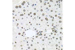 Immunohistochemistry of paraffin-embedded mouse liver using HDAC3 antibody.
