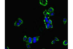 Immunofluorescent analysis of PC-3 cells using ABIN7155221 at dilution of 1:100 and Alexa Fluor 488-congugated AffiniPure Goat Anti-Rabbit IgG(H+L)