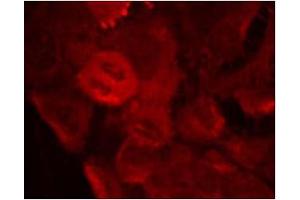 Image no. 1 for anti-Mitogen-Activated Protein Kinase Kinase 2 (MAP2K2) (pThr394) antibody (ABIN196623) (MEK2 Antikörper  (pThr394))