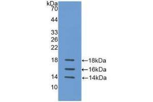Western blot analysis of recombinant Human IL15. (IL-15 Antikörper  (AA 50-162))