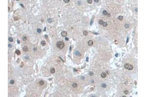 DAB staining on IHC-P; Samples: Human Liver Tissue) (IGF1 Antikörper  (AA 49-118))