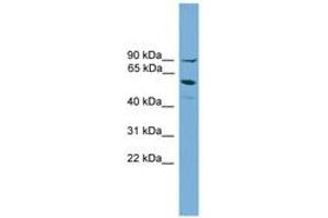 Image no. 1 for anti-Arachidonate 15-Lipoxygenase B (ALOX15B) (AA 401-450) antibody (ABIN6745484) (ALOX15B Antikörper  (AA 401-450))