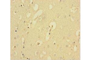Immunohistochemistry of paraffin-embedded human brain tissue using ABIN7146334 at dilution of 1:100 (KCNMA1 Antikörper  (AA 1-86))