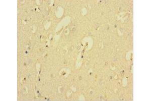 Immunohistochemistry of paraffin-embedded human brain tissue using ABIN7146334 at dilution of 1:100 (KCNMA1 Antikörper  (AA 1-86))