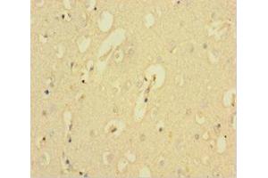 Immunohistochemistry of paraffin-embedded human brain tissue using ABIN7146334 at dilution of 1:100