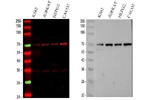 Western blot analysis of CD89/FCAR using anti-CD89/FCAR antibody (ABIN3042678).