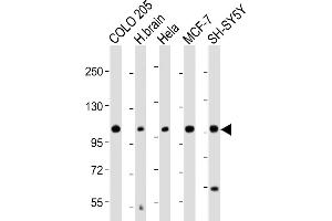 All lanes : Anti-KCNH1 Antibody (C-Term) at 1:2000 dilution Lane 1: COLO 205 whole cell lysate Lane 2: Human brain lysate Lane 3: Hela whole cell lysate Lane 4: MCF-7 whole cell lysate Lane 5: SH-SY5Y whole cell lysate Lysates/proteins at 20 μg per lane. (KCNH1 Antikörper  (AA 787-820))