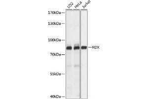 Western blot analysis of extracts of various cell lines using RDX Polyclonal Antibody at dilution of 1:1000. (Radixin Antikörper)