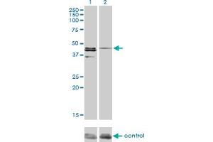 Western blot analysis of CSNK1G1 over-expressed 293 cell line, cotransfected with CSNK1G1 Validated Chimera RNAi (Lane 2) or non-transfected control (Lane 1).