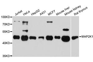 Western blot analysis of extracts of various cell lines, using MAP2K1 antibody. (MEK1 Antikörper  (AA 1-100))
