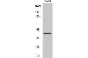 Western Blotting (WB) image for anti-Actin, beta-Like 2 (ACTBL2) (Internal Region) antibody (ABIN3173670) (ACTBL2 Antikörper  (Internal Region))