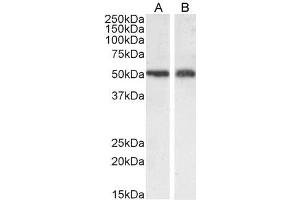 Western Blotting (WB) image for anti-Solute Carrier Family 7, (Cationic Amino Acid Transporter, Y+ System) Member 11 (SLC7A11) (Internal Region) antibody (ABIN190899)