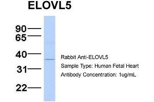 Host:  Rabbit  Target Name:  ELOVL5  Sample Type:  Human Fetal Heart  Antibody Dilution:  1. (ELOVL5 Antikörper  (N-Term))