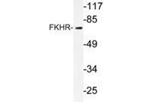 Western blot analysis of FKHR antibody in extracts from HeLa cells. (FOXO1 Antikörper)