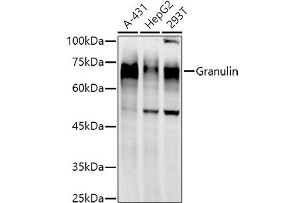 Granulin Antikörper