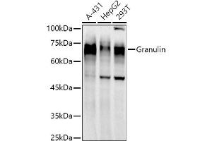 Western blot analysis of extracts of various cell lines, using Granulin antibody  at 1:1000 dilution. (Granulin Antikörper)