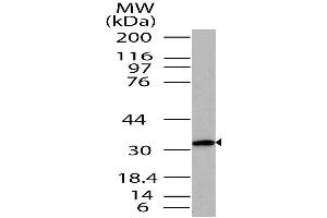 Image no. 1 for anti-ST2V Or ST2 (AA 150-300) antibody (ABIN5027547) (ST2V Or ST2 (AA 150-300) Antikörper)