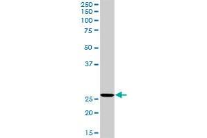 RNH1 MaxPab rabbit polyclonal antibody. (RNH1 Antikörper  (AA 1-461))